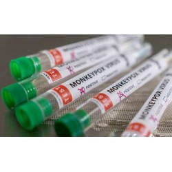 Ministério da Saúde lança campanha sobre a varíola dos macacos